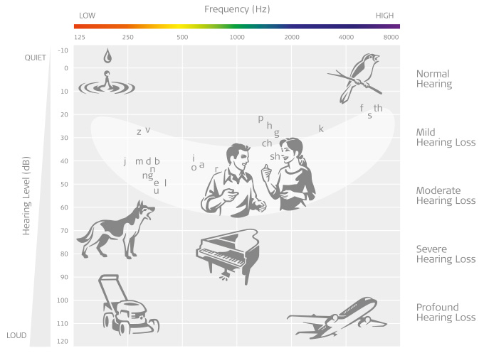 Understanding Audiograms